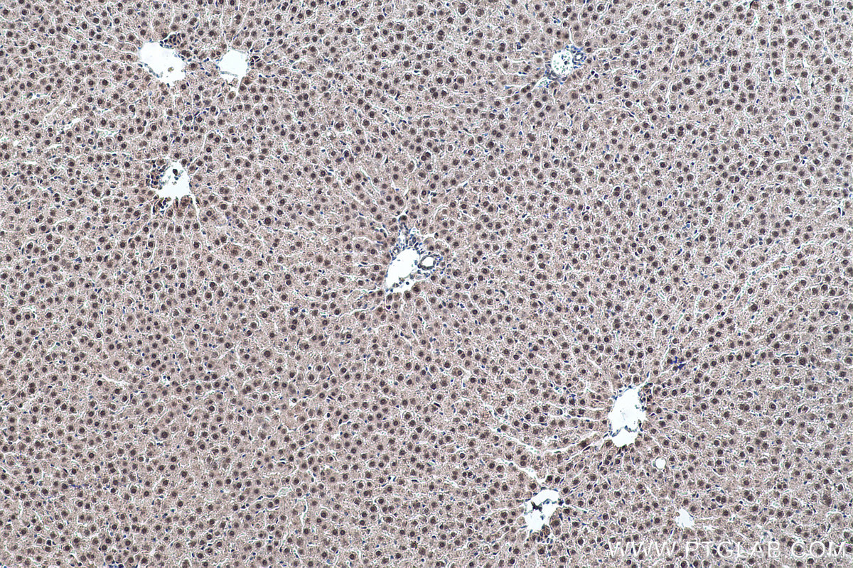 Immunohistochemical analysis of paraffin-embedded rat liver tissue slide using KHC0463 (SF3B5 IHC Kit).