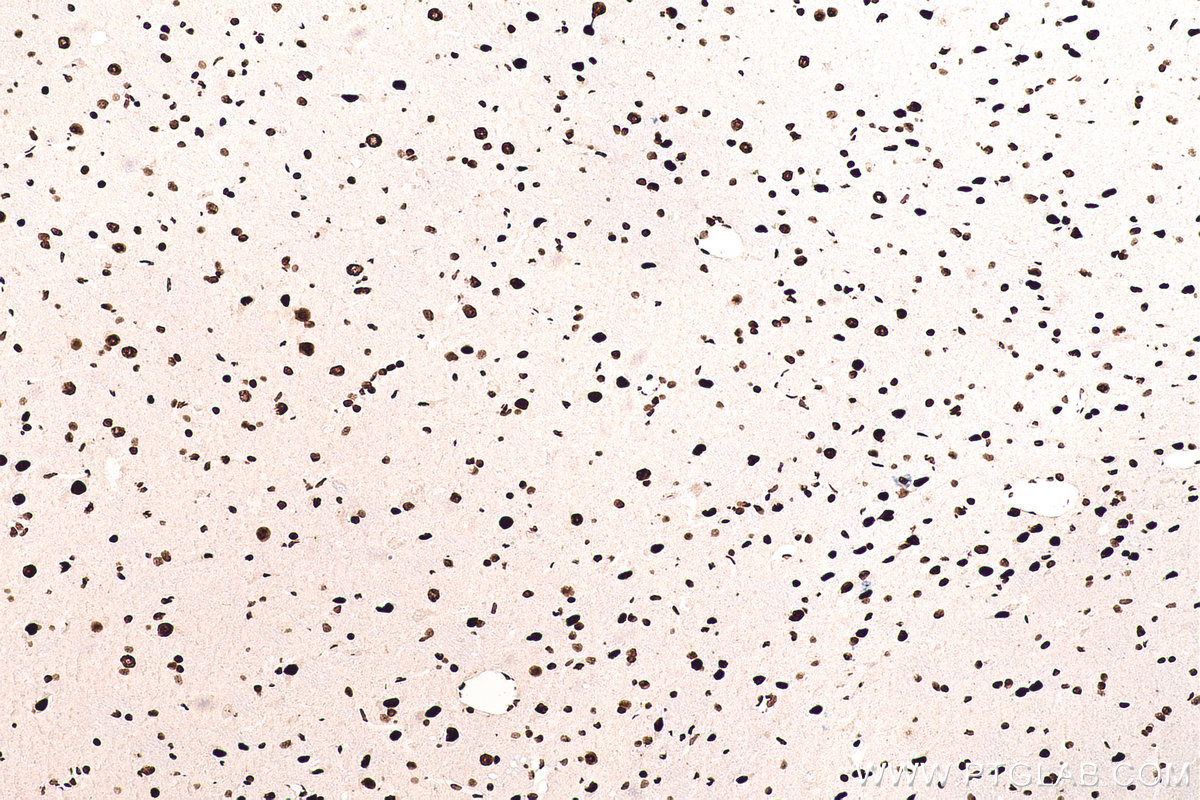 Immunohistochemical analysis of paraffin-embedded rat brain tissue slide using KHC0710 (SFPQ IHC Kit).