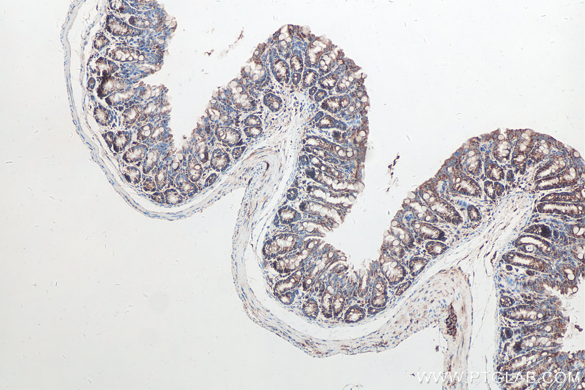 Immunohistochemical analysis of paraffin-embedded mouse colon tissue slide using KHC0215 (SFRP1 IHC Kit).