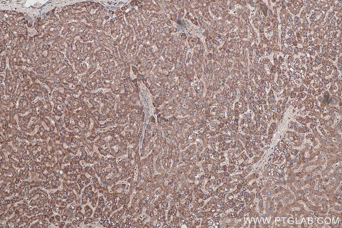 Immunohistochemical analysis of paraffin-embedded human liver tissue slide using KHC0215 (SFRP1 IHC Kit).