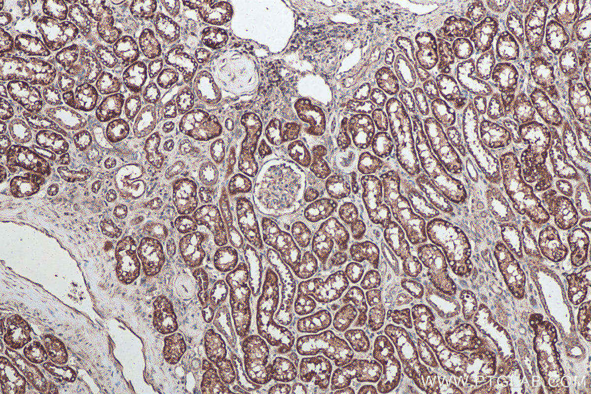 Immunohistochemical analysis of paraffin-embedded human kidney tissue slide using KHC0215 (SFRP1 IHC Kit).