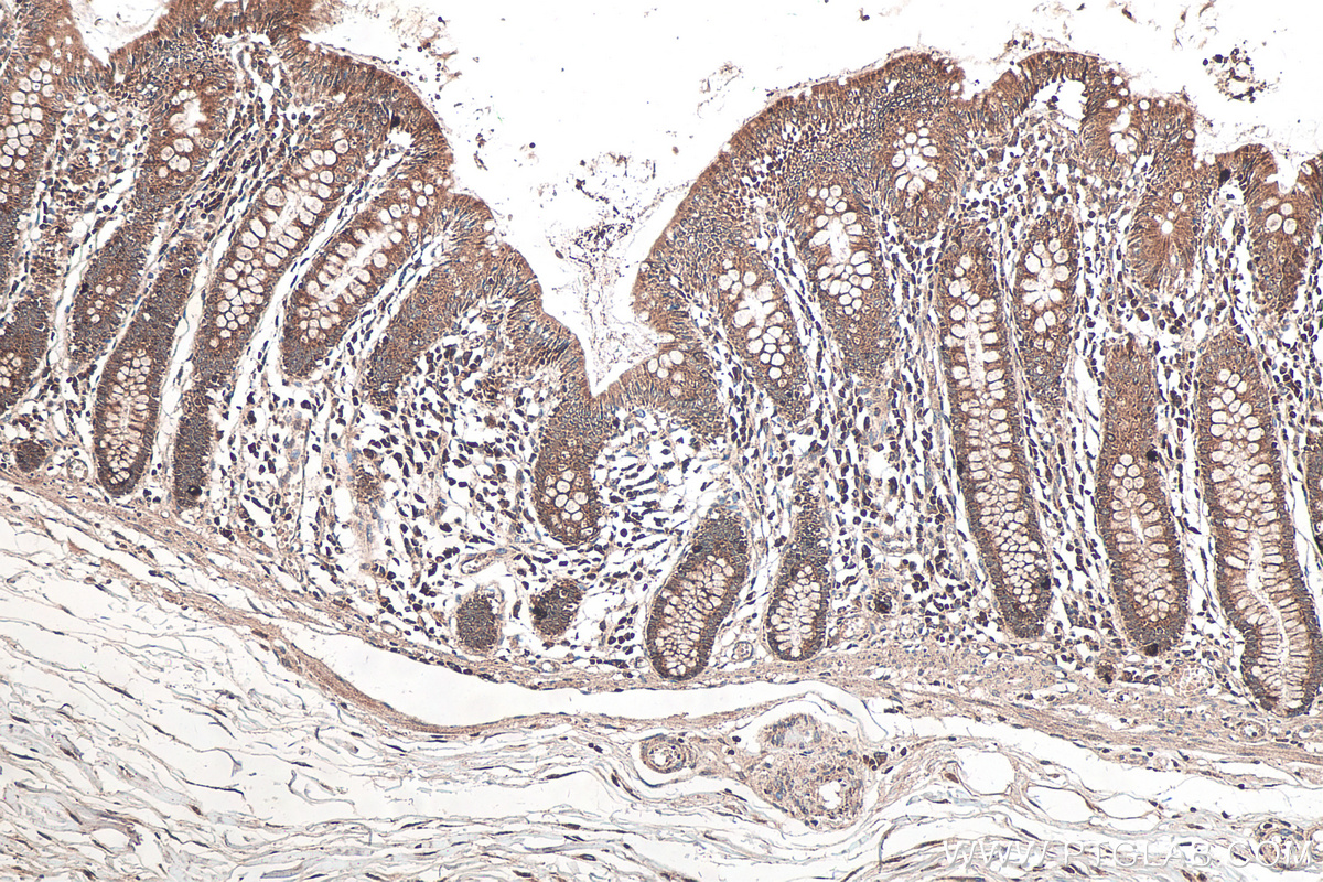 Immunohistochemical analysis of paraffin-embedded human colon tissue slide using KHC0215 (SFRP1 IHC Kit).