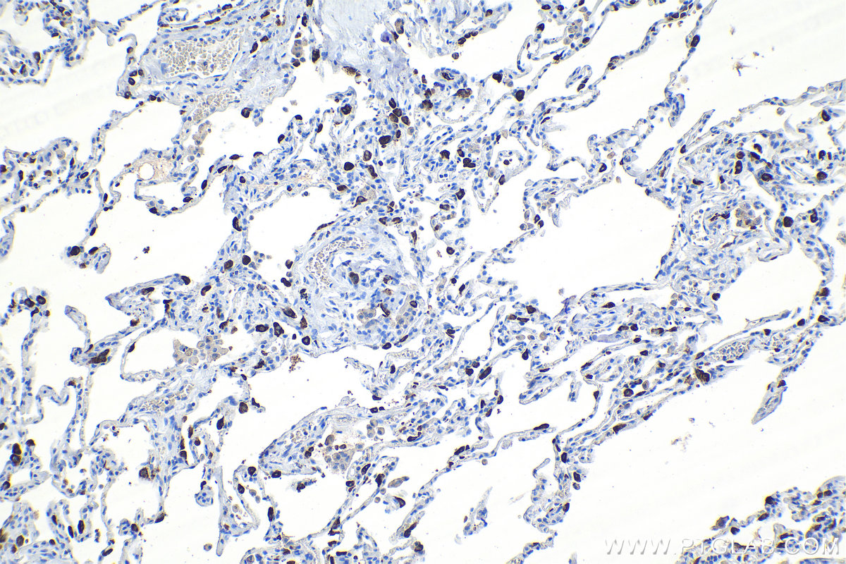 Immunohistochemical analysis of paraffin-embedded human lung tissue slide using KHC1098 (SFTPC IHC Kit).