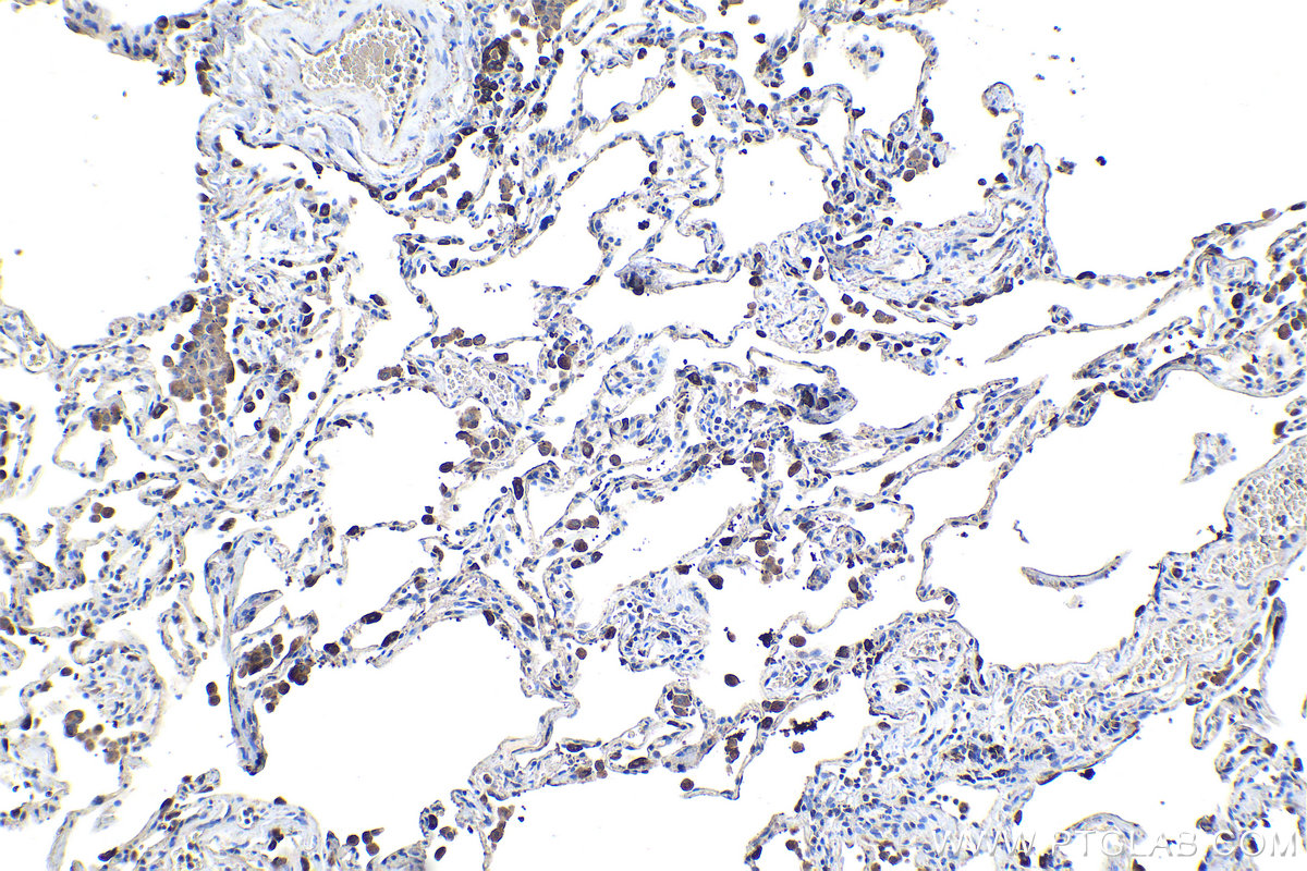 Immunohistochemical analysis of paraffin-embedded human lung tissue slide using KHC1054 (SFTPD IHC Kit).