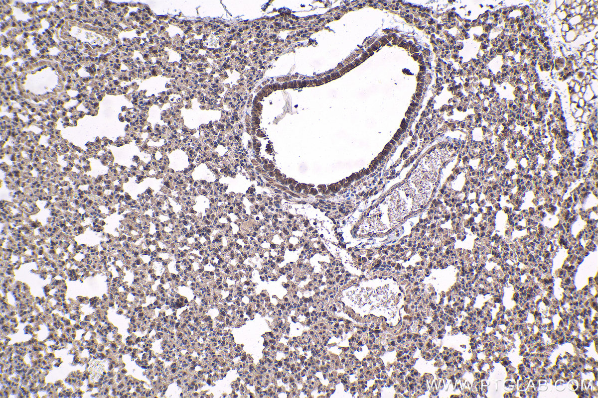 Immunohistochemical analysis of paraffin-embedded mouse lung tissue slide using KHC1416 (SGK1 IHC Kit).