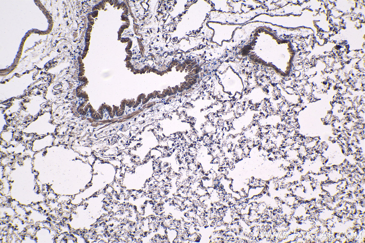 Immunohistochemical analysis of paraffin-embedded rat lung tissue slide using KHC1416 (SGK1 IHC Kit).