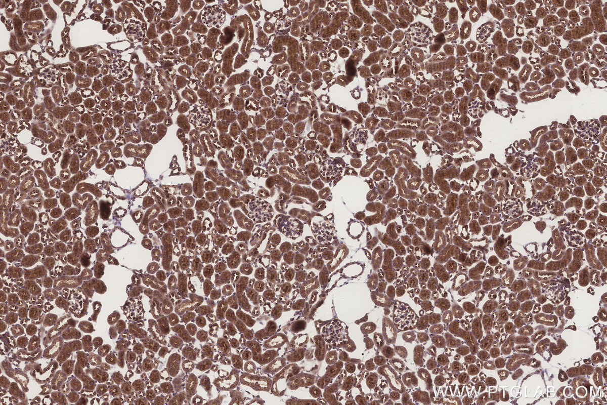 Immunohistochemical analysis of paraffin-embedded mouse kidney tissue slide using KHC3284 (SGMS1 IHC Kit).