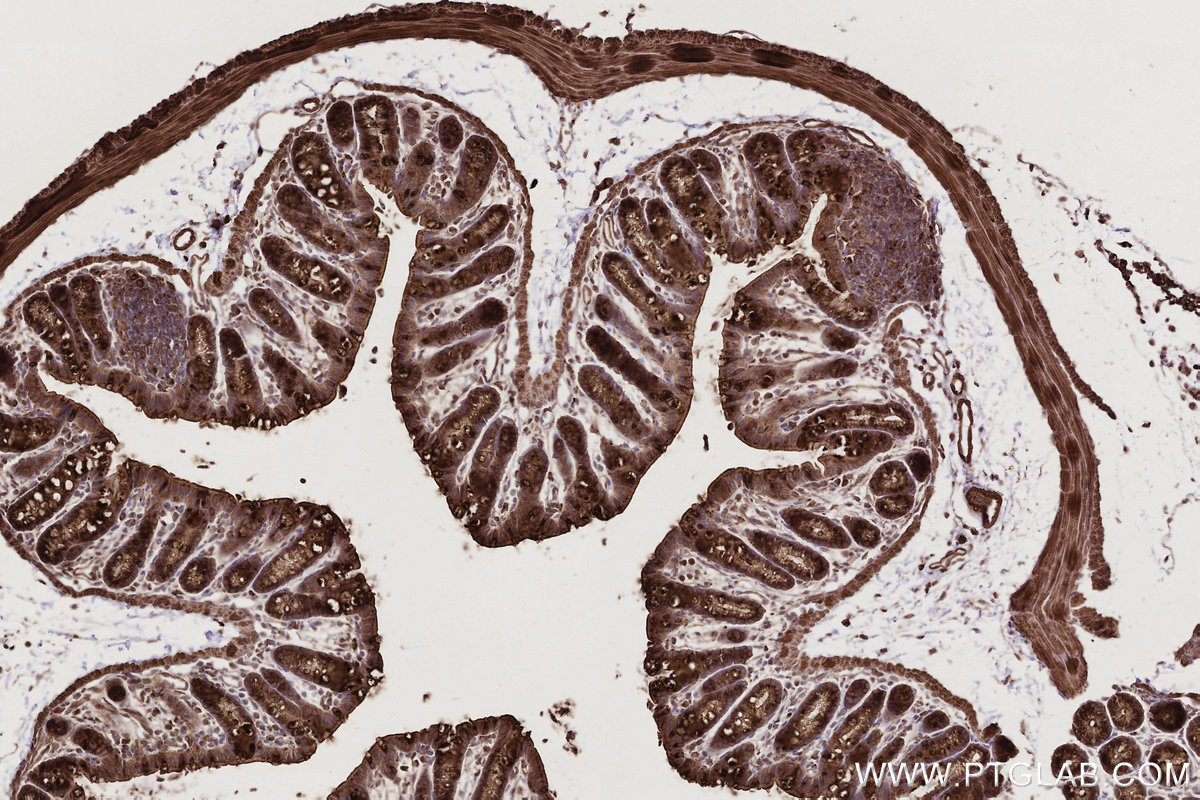 Immunohistochemical analysis of paraffin-embedded mouse colon tissue slide using KHC2798 (SGSM3 IHC Kit).