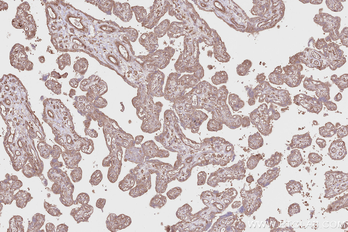 Immunohistochemical analysis of paraffin-embedded human placenta tissue slide using KHC2798 (SGSM3 IHC Kit).