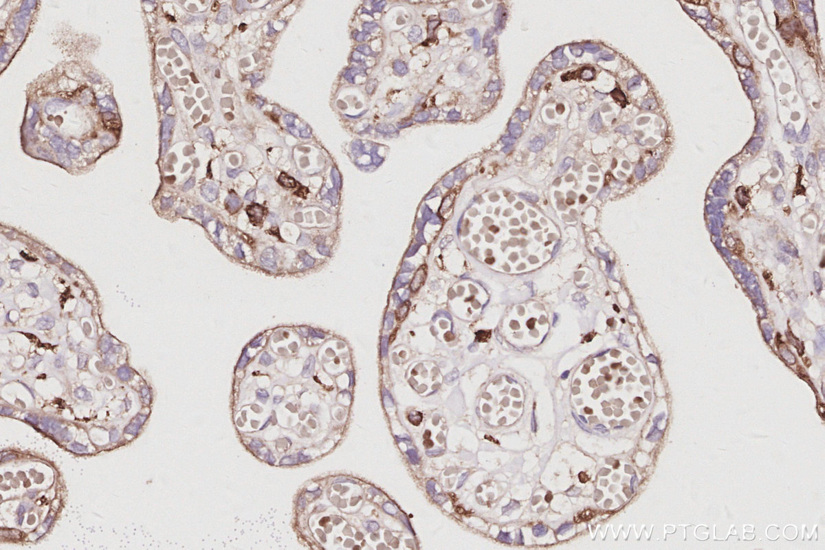 Immunohistochemical analysis of paraffin-embedded human placenta tissue slide using KHC3064 (SH3BP1 IHC Kit). Immunohistochemical analysis of paraffin-embedded human placenta tissue slide using KHC3064 (SH3BP1 IHC Kit).