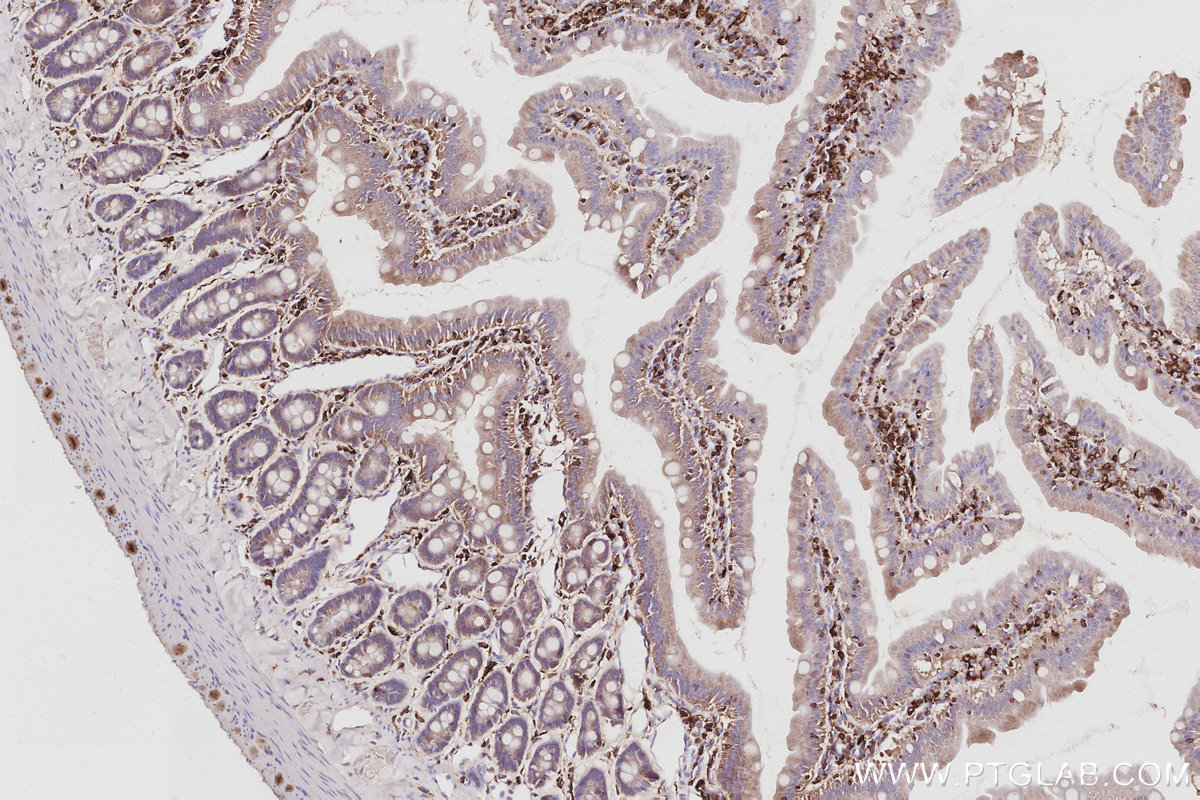 Immunohistochemical analysis of paraffin-embedded rat small intestine tissue slide using KHC3064 (SH3BP1 IHC Kit). Immunohistochemical analysis of paraffin-embedded rat small intestine tissue slide using KHC3064 (SH3BP1 IHC Kit).