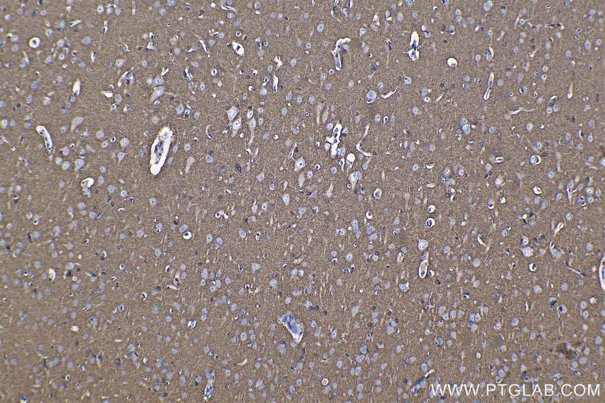 Immunohistochemical analysis of paraffin-embedded rat brain tissue slide using KHC1260 (SH3GLB2 IHC Kit).