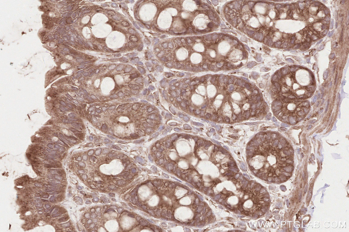 Immunohistochemical analysis of paraffin-embedded rat colon tissue slide using KHC2625 (SH3RF1/POSH IHC Kit).