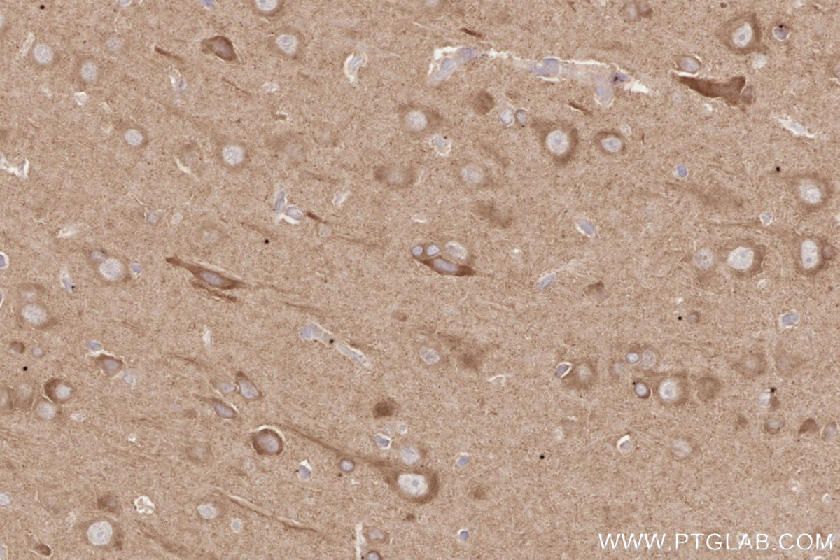 Immunohistochemical analysis of paraffin-embedded rat brain tissue slide using KHC2625 (SH3RF1/POSH IHC Kit).