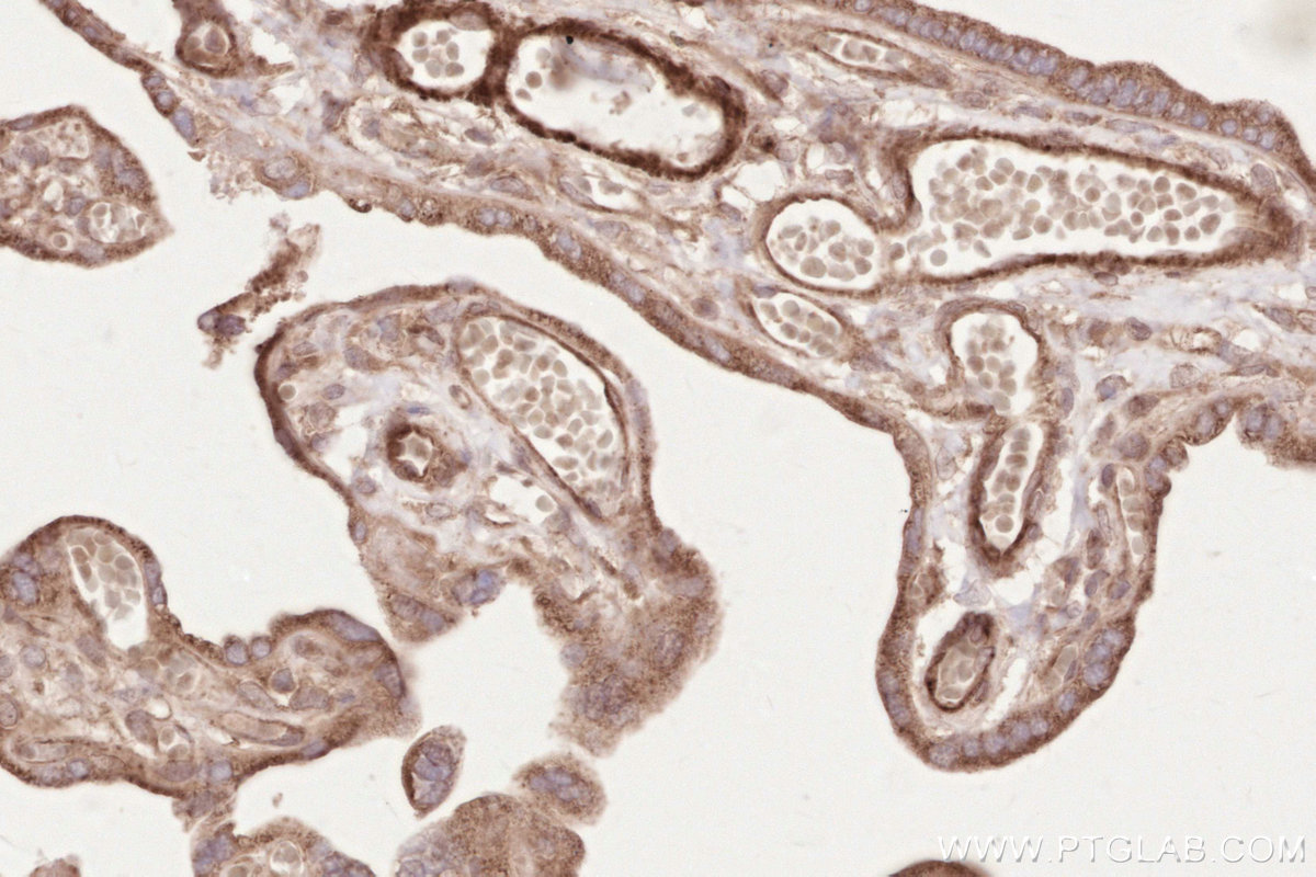 Immunohistochemical analysis of paraffin-embedded human placenta tissue slide using KHC2625 (SH3RF1/POSH IHC Kit).