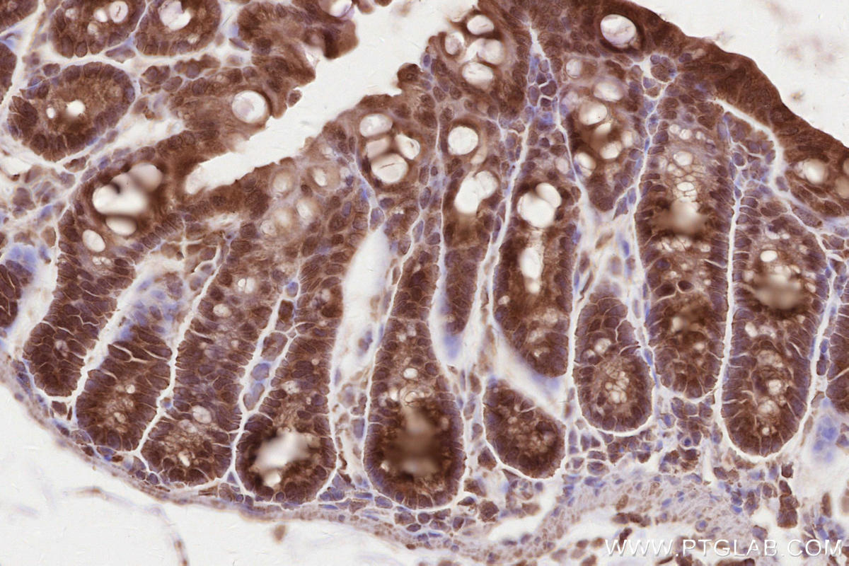 Immunohistochemical analysis of paraffin-embedded mouse colon tissue slide using KHC2625 (SH3RF1/POSH IHC Kit).
