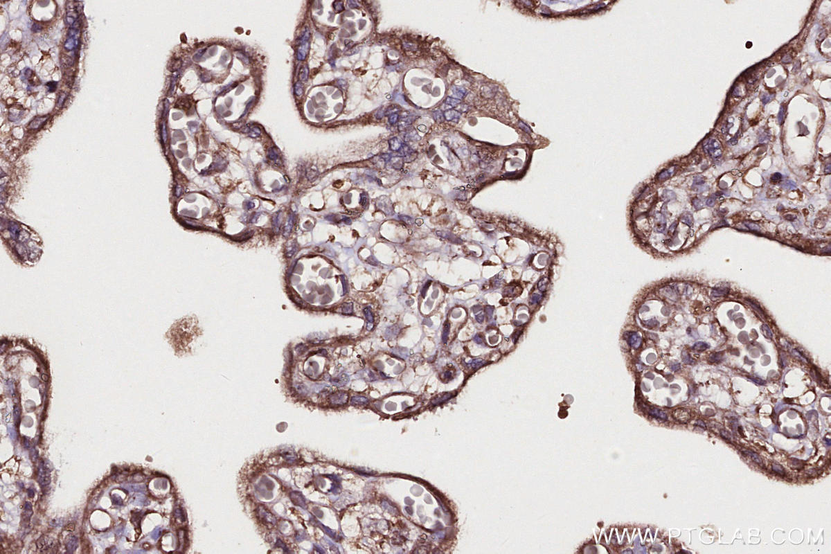 Immunohistochemical analysis of paraffin-embedded human placenta tissue slide using KHC2707 (SHKBP1 IHC Kit).