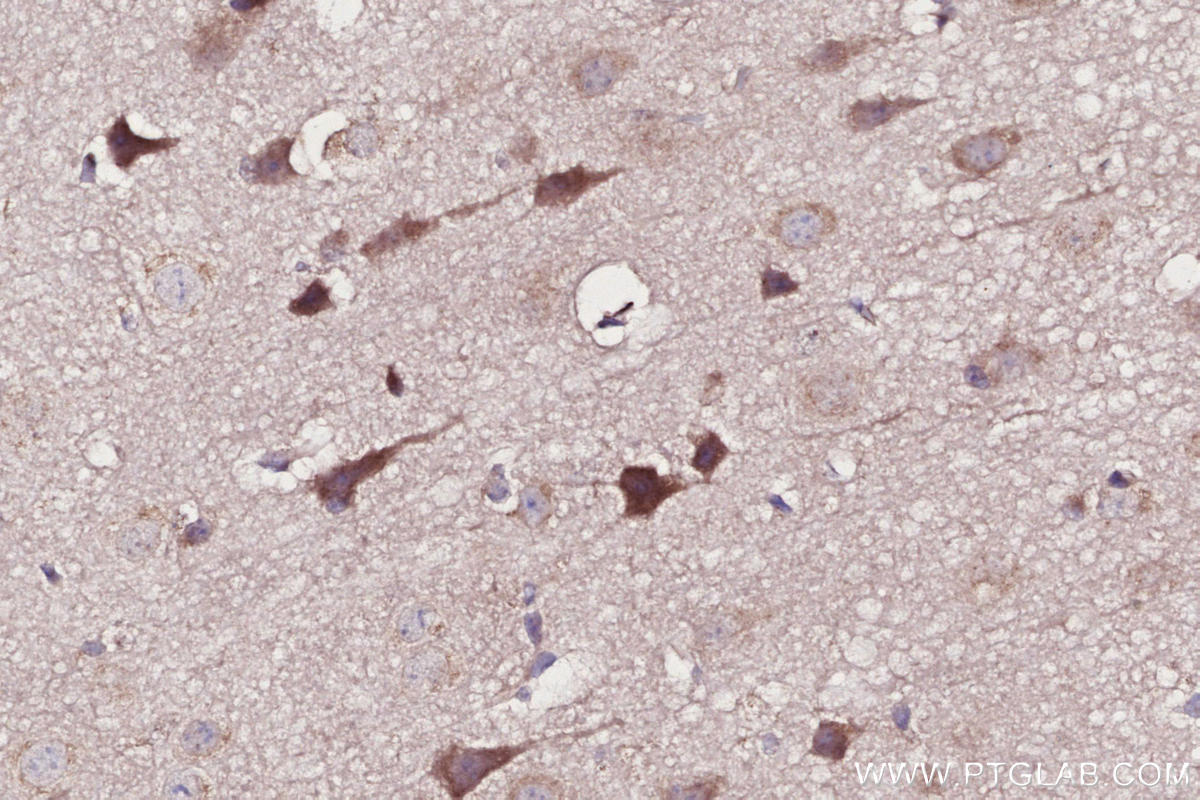 Immunohistochemical analysis of paraffin-embedded mouse brain tissue slide using KHC2707 (SHKBP1 IHC Kit).