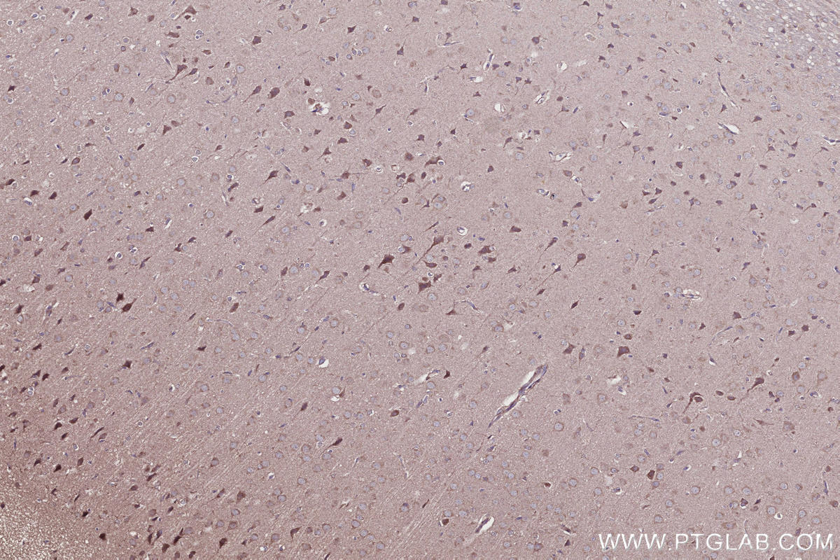 Immunohistochemical analysis of paraffin-embedded rat brain tissue slide using KHC2707 (SHKBP1 IHC Kit).
