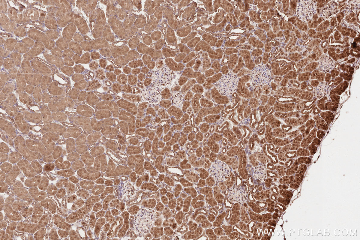Immunohistochemical analysis of paraffin-embedded rat kidney tissue slide using KHC2604 (SHLD3 IHC Kit).