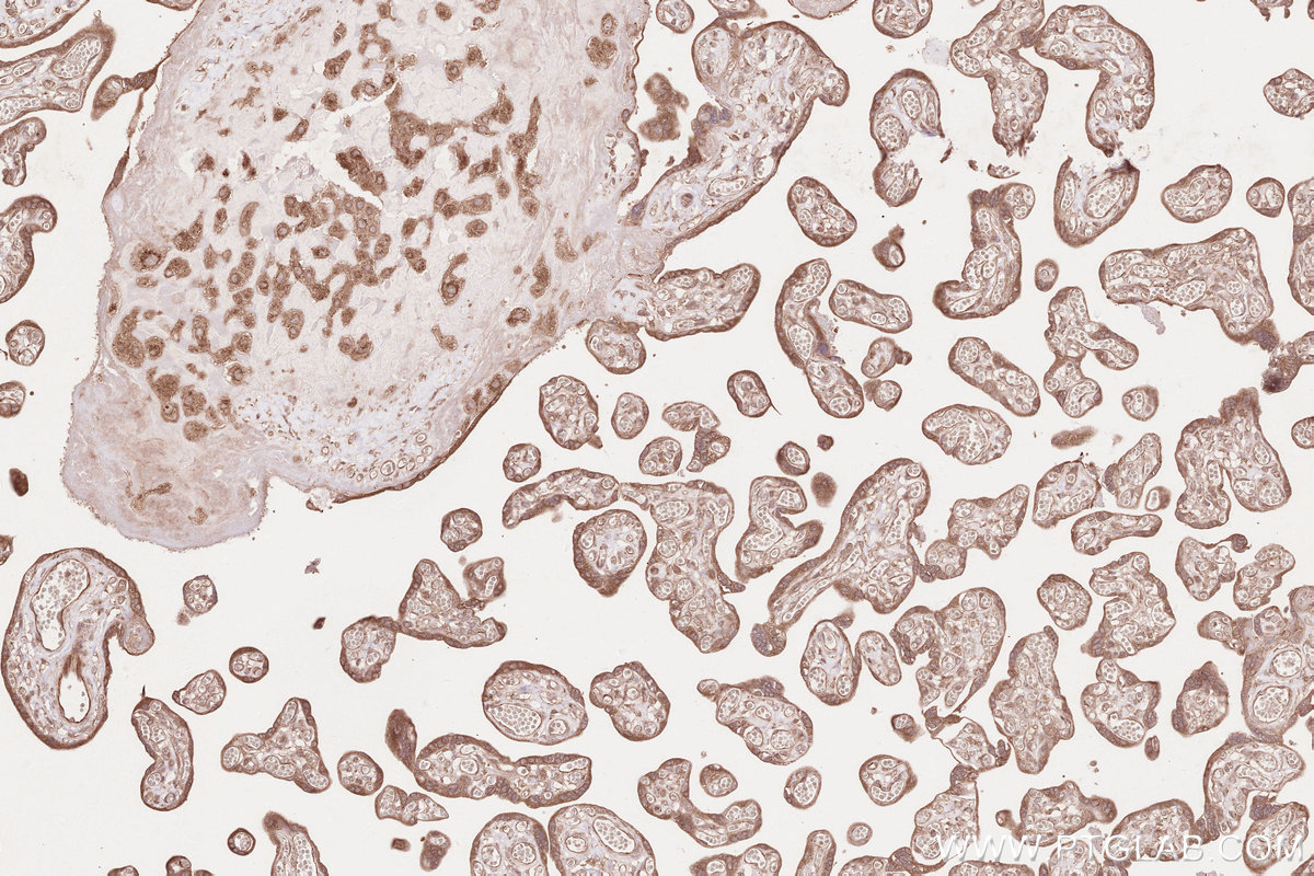 Immunohistochemical analysis of paraffin-embedded human placenta tissue slide using KHC2604 (SHLD3 IHC Kit).