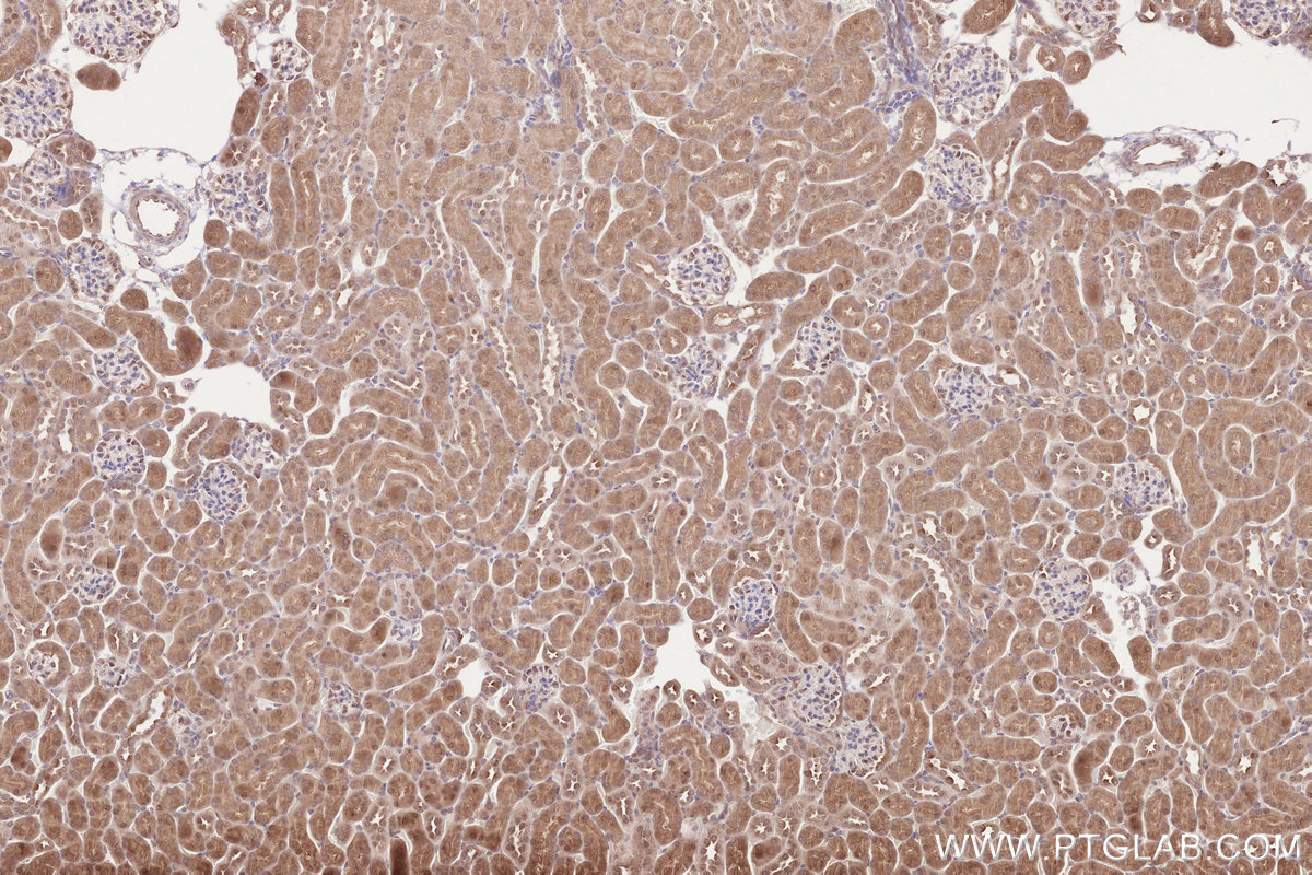 Immunohistochemical analysis of paraffin-embedded mouse kidney tissue slide using KHC2604 (SHLD3 IHC Kit).