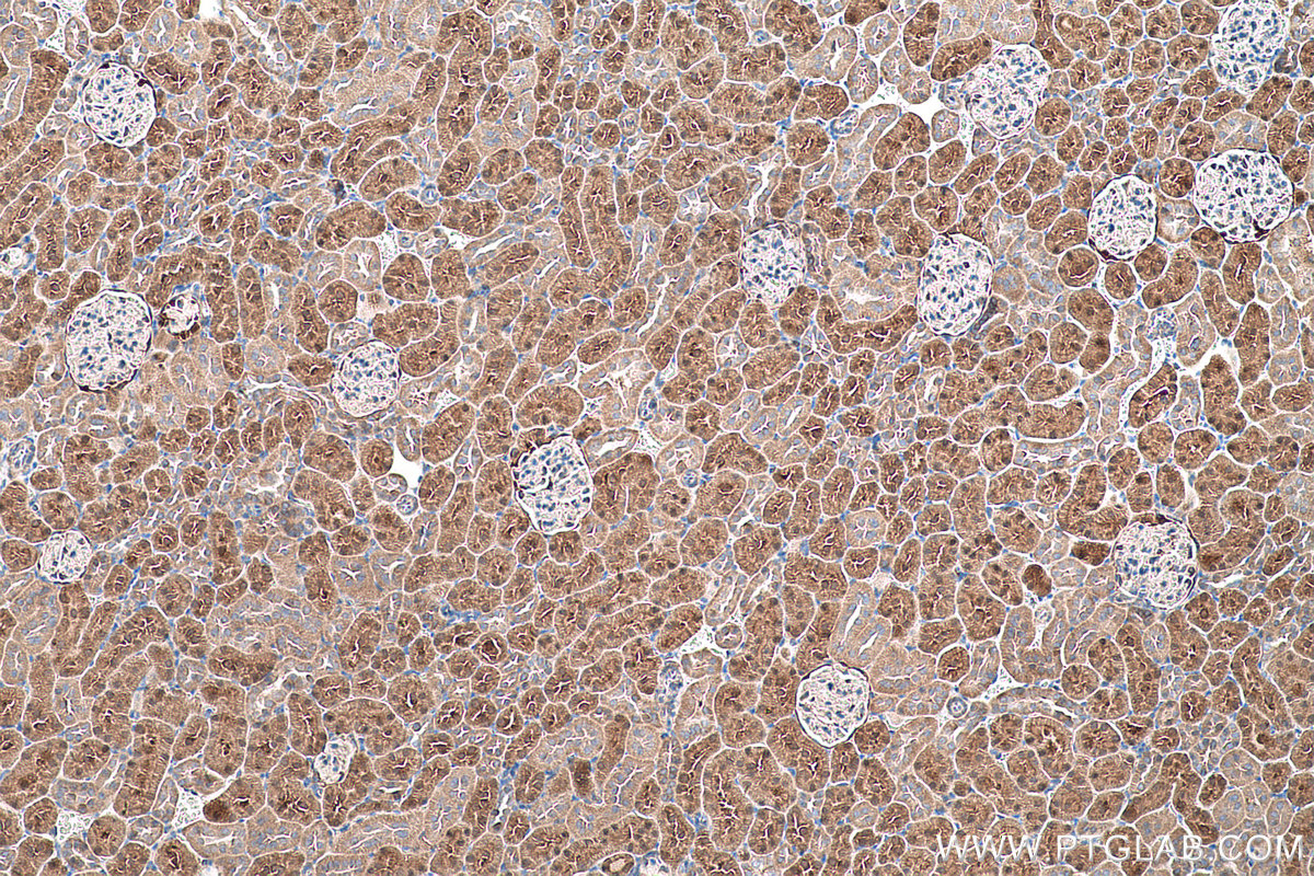 Immunohistochemical analysis of paraffin-embedded rat kidney tissue slide using KHC0566 (SHMT1 IHC Kit).