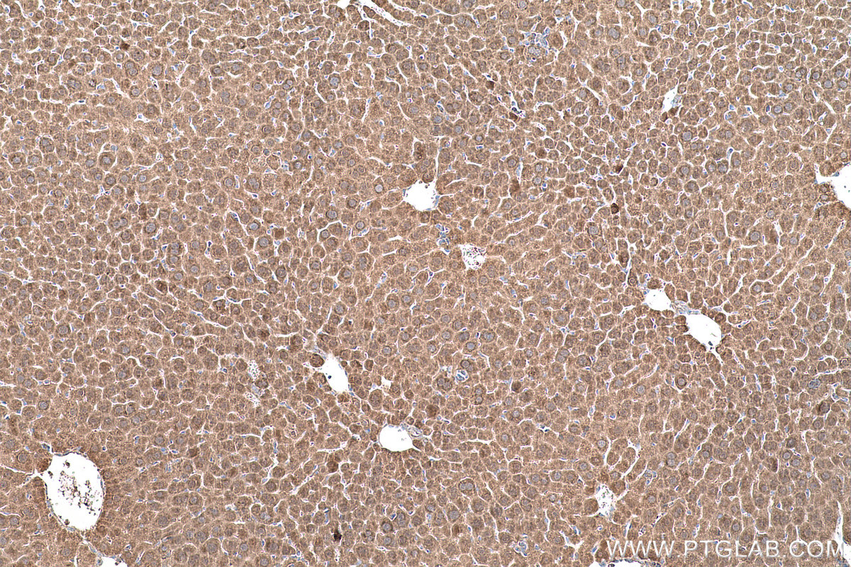 Immunohistochemical analysis of paraffin-embedded mouse liver tissue slide using KHC0566 (SHMT1 IHC Kit).