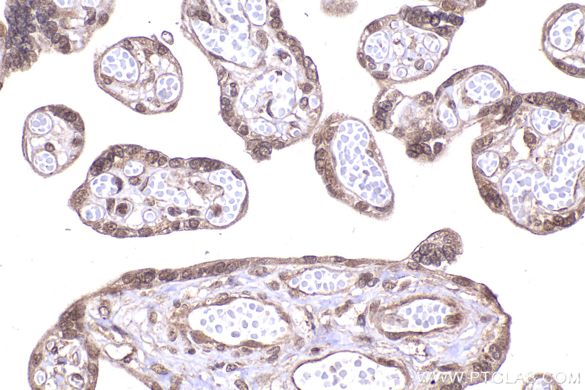 Immunohistochemical analysis of paraffin-embedded human placenta tissue slide using KHC2076 (SIAH2 IHC Kit).