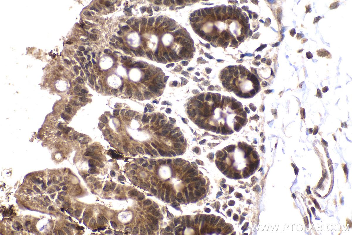 Immunohistochemical analysis of paraffin-embedded mouse intestine tissue slide using KHC2076 (SIAH2 IHC Kit).