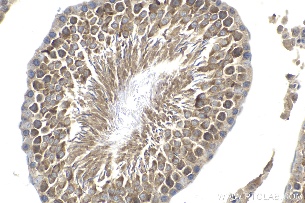 Immunohistochemical analysis of paraffin-embedded rat testis tissue slide using KHC2060 (SIP1 IHC Kit).