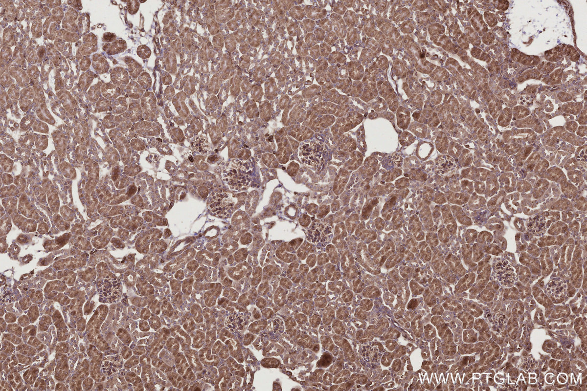 Immunohistochemical analysis of paraffin-embedded mouse kidney tissue slide using KHC2792 (SIPA1 IHC Kit).