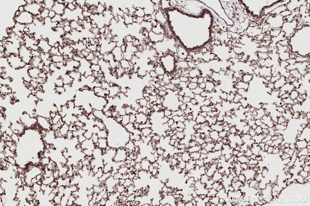Immunohistochemical analysis of paraffin-embedded mouse lung tissue slide using KHC2792 (SIPA1 IHC Kit).