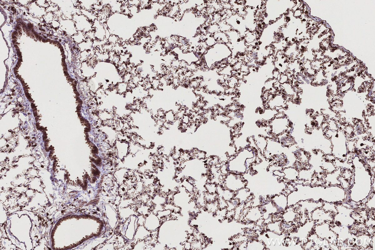 Immunohistochemical analysis of paraffin-embedded rat lung tissue slide using KHC2792 (SIPA1 IHC Kit).