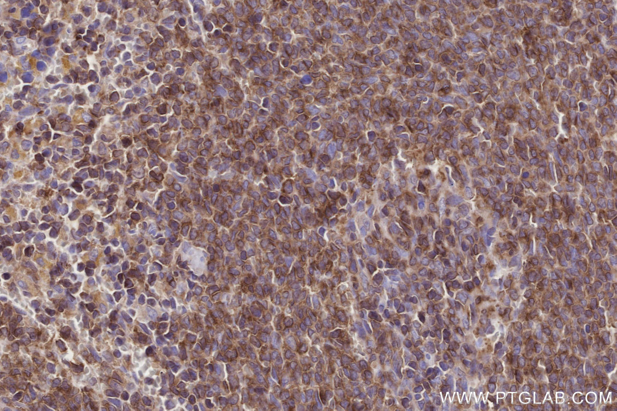 Immunohistochemical analysis of paraffin-embedded rat spleen tissue slide using KHC2792 (SIPA1 IHC Kit).