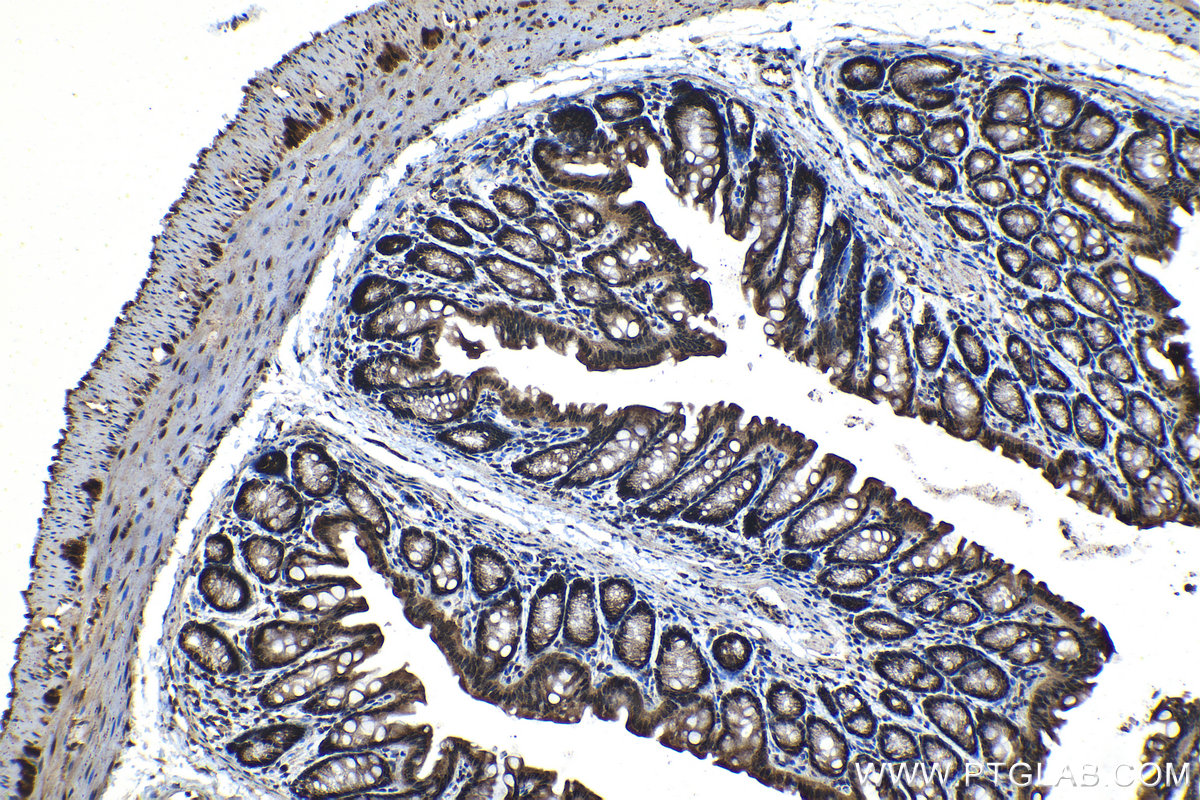 Immunohistochemical analysis of paraffin-embedded mouse colon tissue slide using KHC1207 (SIRT1 IHC Kit).