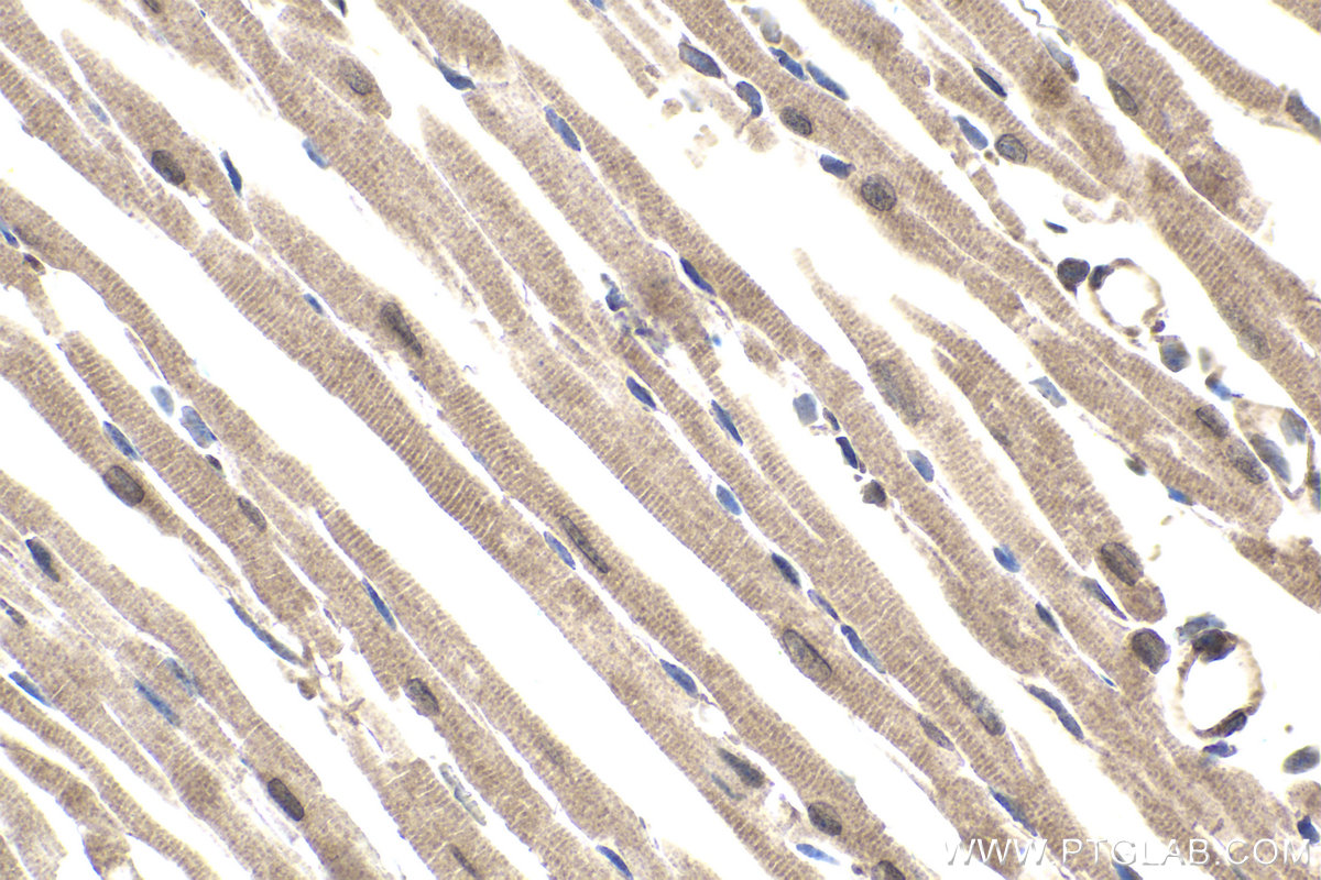 Immunohistochemical analysis of paraffin-embedded mouse heart tissue slide using KHC1821 (SIRT2 IHC Kit).