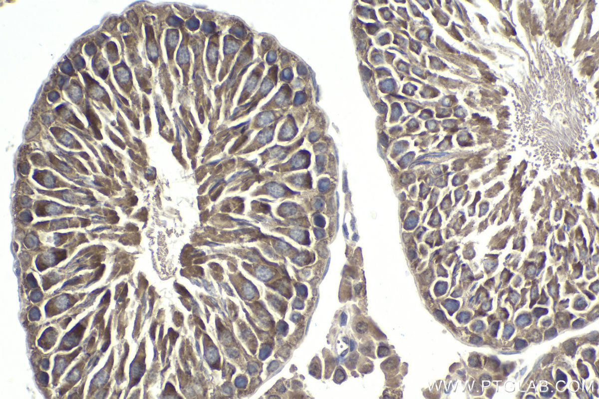 Immunohistochemical analysis of paraffin-embedded rat testis tissue slide using KHC1821 (SIRT2 IHC Kit).