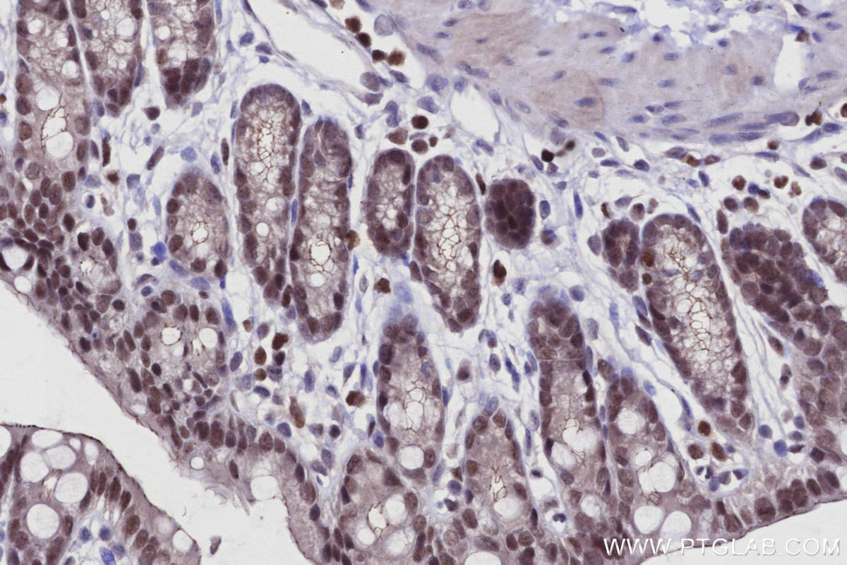 Immunohistochemical analysis of paraffin-embedded mouse colon tissue slide using KHC2950 (SIRT7 IHC Kit).
