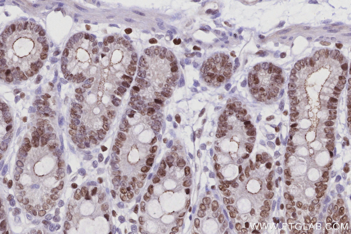 Immunohistochemical analysis of paraffin-embedded rat colon tissue slide using KHC2950 (SIRT7 IHC Kit).