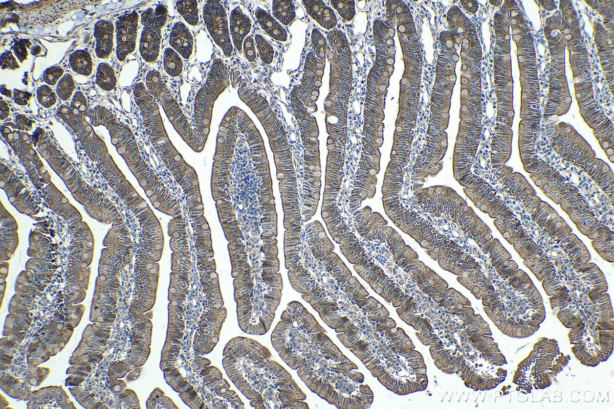 Immunohistochemical analysis of paraffin-embedded rat small intestine tissue slide using KHC1443 (SIVA1 IHC Kit).