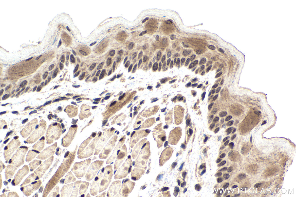 Immunohistochemical analysis of paraffin-embedded mouse tongue tissue slide using KHC1988 (SIX4 IHC Kit).