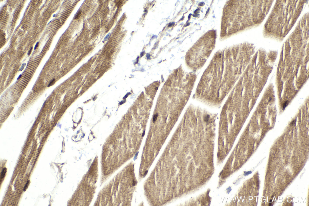Immunohistochemical analysis of paraffin-embedded mouse skeletal muscle tissue slide using KHC1988 (SIX4 IHC Kit).