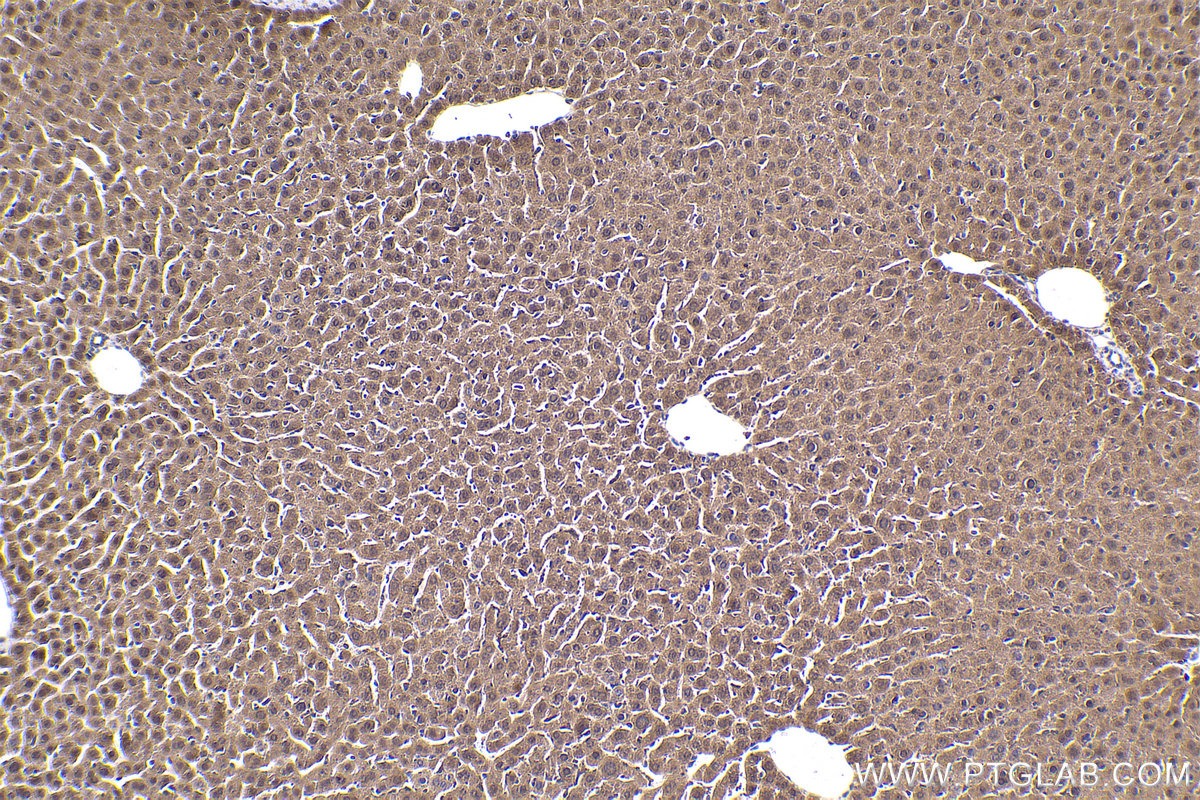 Immunohistochemical analysis of paraffin-embedded mouse liver tissue slide using KHC1830 (SIX5 IHC Kit).