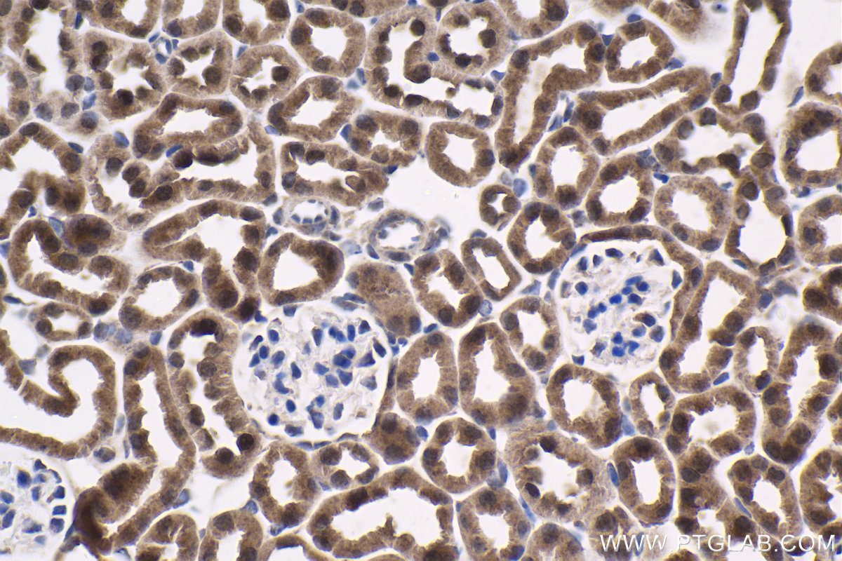 Immunohistochemical analysis of paraffin-embedded mouse kidney tissue slide using KHC1830 (SIX5 IHC Kit).