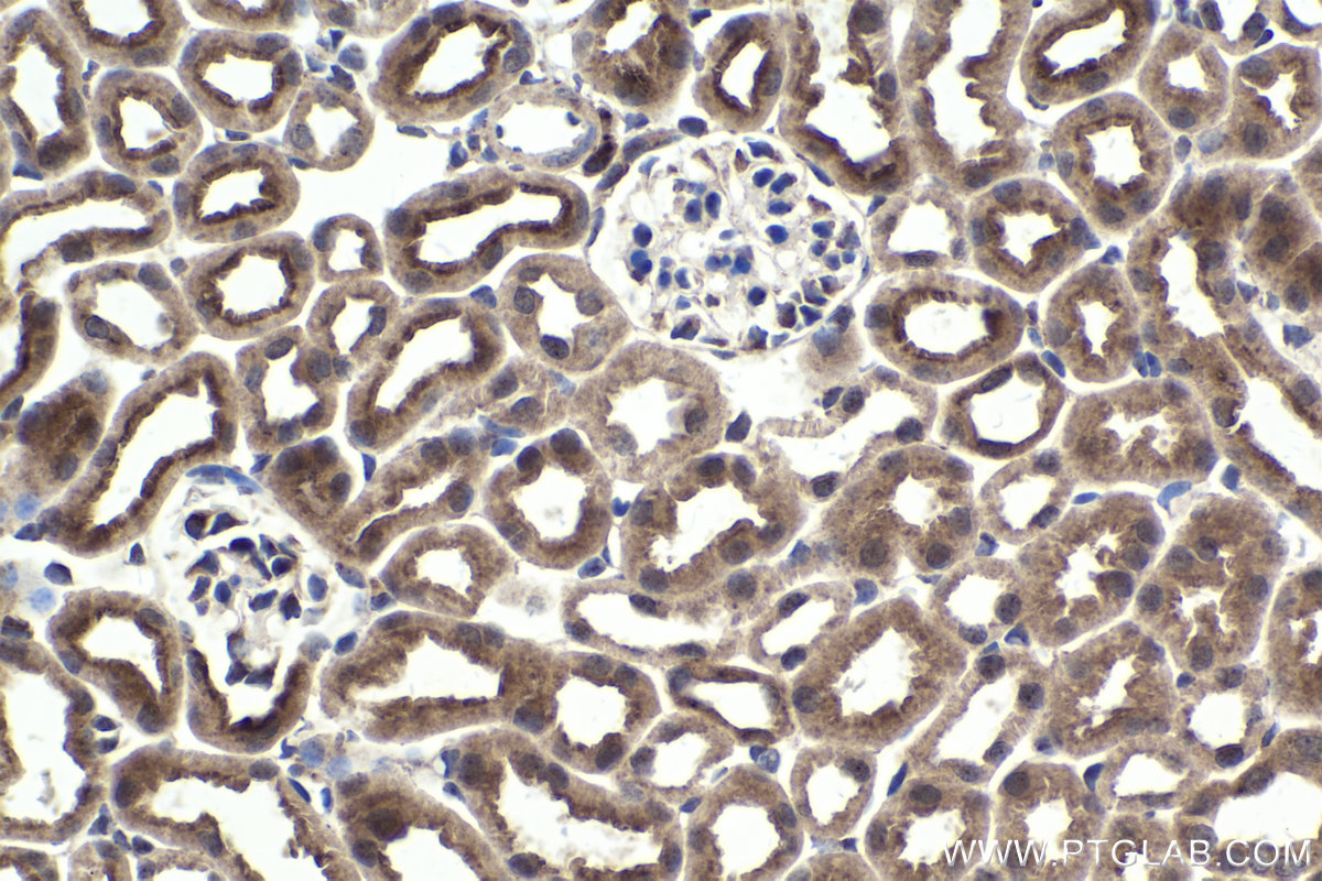 Immunohistochemical analysis of paraffin-embedded mouse kidney tissue slide using KHC1709 (SKP2 IHC Kit).