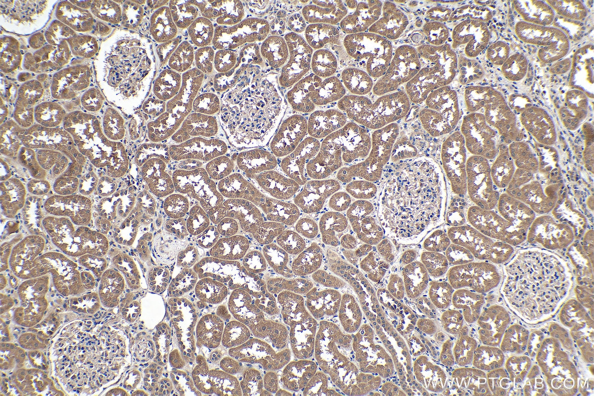 Immunohistochemical analysis of paraffin-embedded human kidney tissue slide using KHC0197 (SLC22A7 IHC Kit).