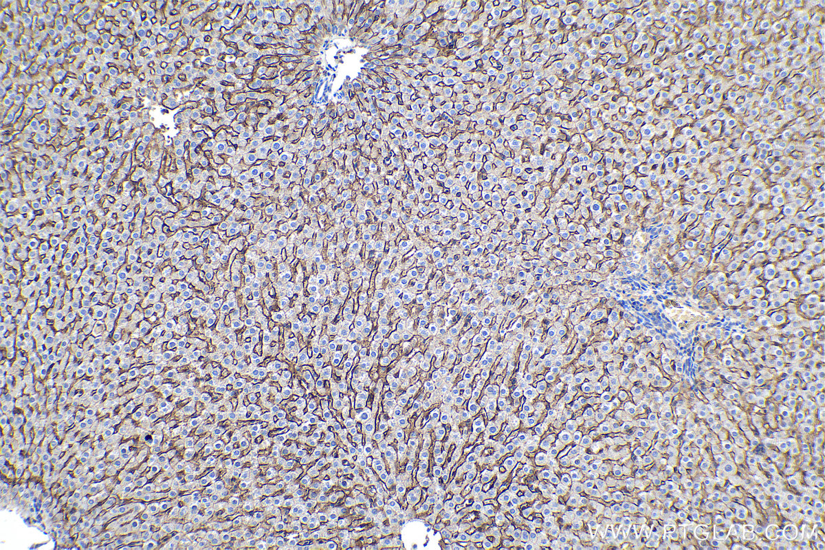 Immunohistochemical analysis of paraffin-embedded mouse liver tissue slide using KHC0197 (SLC22A7 IHC Kit).