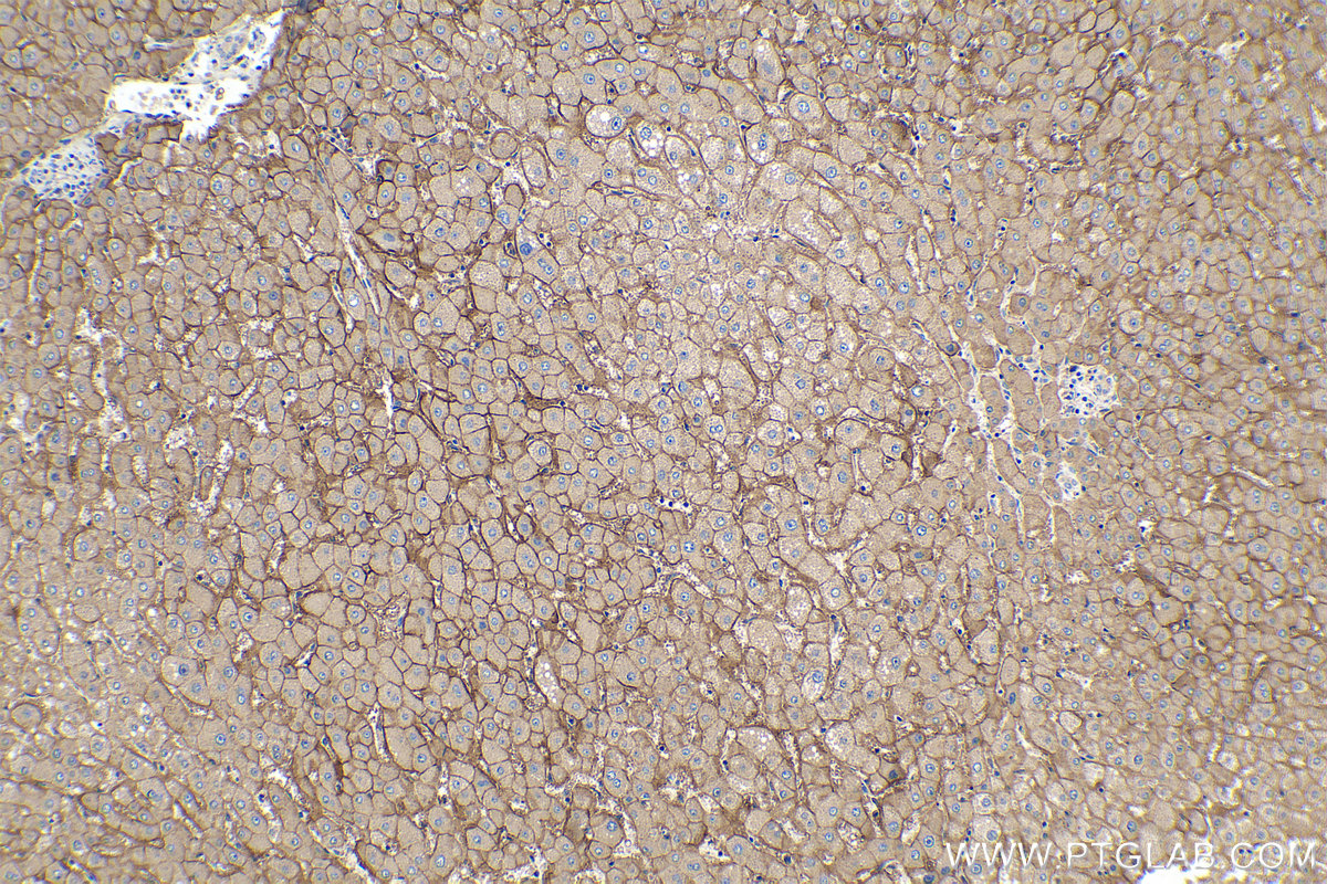 Immunohistochemical analysis of paraffin-embedded human liver tissue slide using KHC0197 (SLC22A7 IHC Kit).