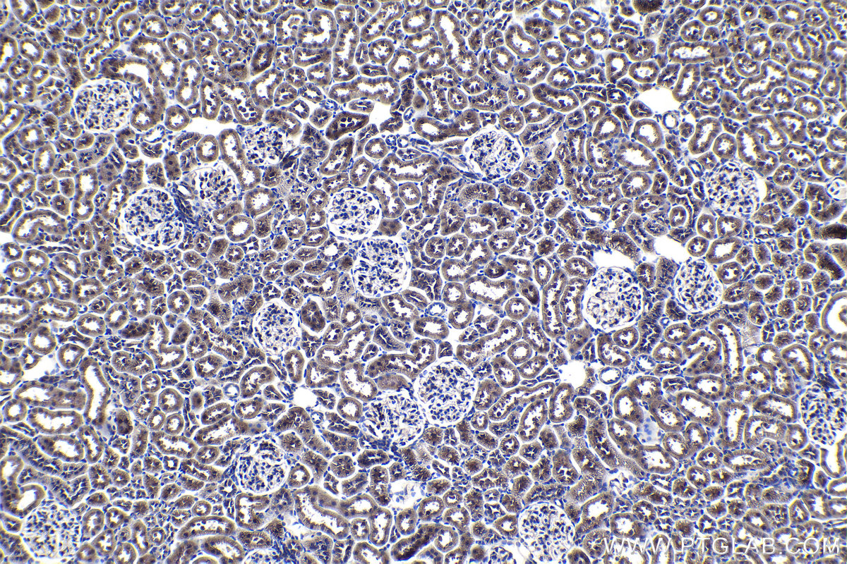 Immunohistochemical analysis of paraffin-embedded rat kidney tissue slide using KHC1087 (SLC25A42 IHC Kit).